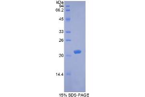SDS-PAGE analysis of Rabbit BDNF Protein. (BDNF 蛋白)