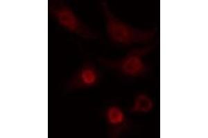 ABIN6274267 staining COLO205 cells by IF/ICC. (CLK2 抗体  (N-Term))