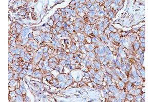Image no. 1 for anti-CD44 Standard (CD44s) antibody (ABIN6151476) (CD44 Standard 抗体)