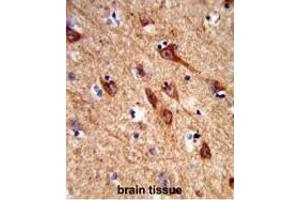 Immunohistochemistry (Paraffin-embedded Sections) (IHC (p)) image for anti-Amiloride-Sensitive Cation Channel 1, Neuronal (ACCN1) (AA 127-156), (Middle Region) antibody (ABIN950536)