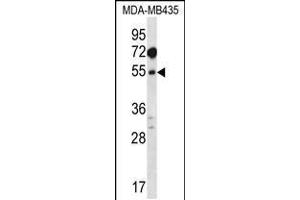 Western blot analysis in MDA-MB435 cell line lysates (35ug/lane). (MAT1A 抗体  (N-Term))