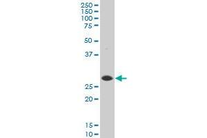 DNAJB6 polyclonal antibody (A01), Lot # 060309JCS1. (DNAJB6 抗体  (AA 1-241))