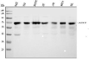 Western blot analysis of ATF2 using anti-ATF2 antibody (ABIN3043791). (ATF2 抗体  (AA 93-450))