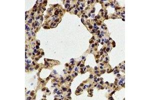Immunohistochemistry (IHC) image for anti-Peptidyl Arginine Deiminase, Type IV (PADI4) antibody (ABIN7306048)