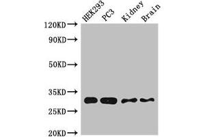 Western Blot Positive WB detected in:HEK293 whole cell lysate,PC-3 whole cell lysate,Mouse kidney tissue,Mouse brain tissue All lanes:CBR1 antibody at 2. (CBR1 抗体  (AA 176-268))