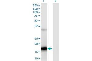 Western Blot analysis of ZCCHC13 expression in transfected 293T cell line by ZCCHC13 monoclonal antibody (M02), clone 4G11. (ZCCHC13 抗体  (AA 1-166))