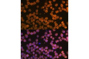 Immunofluorescence analysis of THP-1 cells using TNFRSF10A Polyclonal Antibody (ABIN6127583, ABIN6149301, ABIN6149303 and ABIN6216204) at dilution of 1:100 (40x lens). (TNFRSF10A 抗体  (AA 269-468))