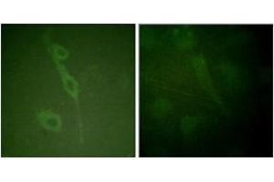 Immunofluorescence analysis of HuvEc cells, using IL-7R/CD127 (Phospho-Tyr449) Antibody. (IL7R 抗体  (pTyr449))