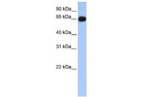 ALAS1 antibody used at 1 ug/ml to detect target protein. (ALAS1 抗体  (N-Term))