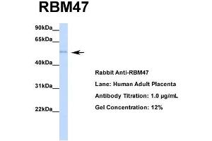 Host: Rabbit  Target Name: RBM47  Sample Tissue: Human Adult Placenta  Antibody Dilution: 1. (RBM47 抗体  (Middle Region))