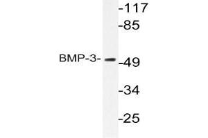 Western blot (WB) analyzes of BMP-3 antibody in extracts from HeLa cells. (BMP3 抗体)