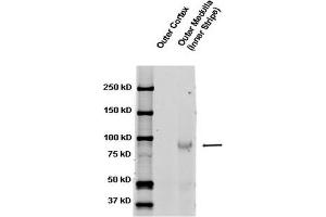 Western blot analysis of Rat kidney tissue lysates showing detection of ENaC protein using Rabbit Anti-ENaC Polyclonal Antibody . (SCNN1A 抗体  (AA 617-638) (FITC))