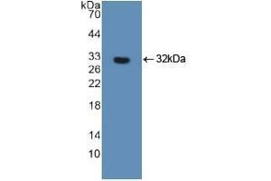 Western blot analysis of recombinant Human FOXO3. (FOXO3 抗体  (AA 369-633))