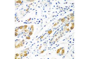 Immunohistochemistry of paraffin-embedded human stomach using BLVRB antibody (ABIN5975104) at dilution of 1/100 (40x lens). (BLVRB 抗体)