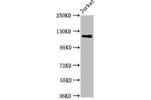 Western Blot Positive WB detected in: Jurkat whole cell lysate All lanes: SREBF1 antibody at 5. (SREBF1 抗体  (AA 38-201))