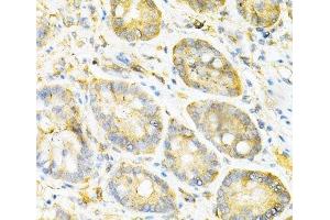Immunohistochemistry of paraffin-embedded Mouse stomach using SULT2A1 Polyclonal Antibody at dilution of 1:200 (40x lens). (SULT2A1 抗体)