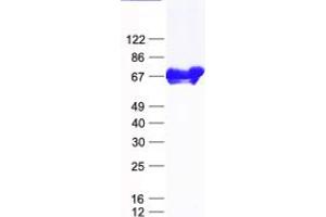 Western Blotting (WB) image for NEDD4 Binding Protein 2-Like 2 (N4BP2L2) protein (His tag) (ABIN2726746)