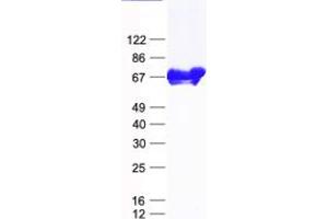 Validation with Western Blot (N4BP2L2 Protein (His tag))