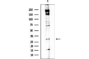 Western blot analysis of lysates from EC304 cells, using GNT Antibody at 1/1000 dilution.