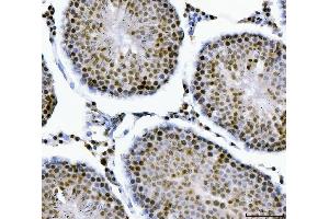 IHC analysis of MBNL1 using anti-MBNL1 antibody (ABIN7602608).