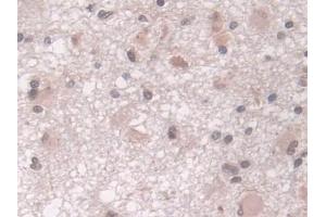 Immunohistochemistry (IHC) image for anti-Proteasome (Prosome, Macropain) Subunit, beta Type, 8 (Large Multifunctional Peptidase 7) (PSMB8) (AA 75-261) antibody (ABIN7440236)