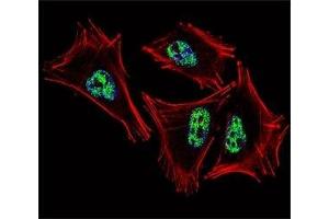 Fluorescent confocal image of A2058 cell stained with PROX1 antibody at 1:25. (PROX1 抗体  (AA 492-522))