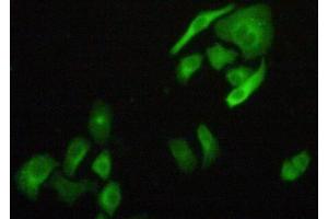Figure:FITC staining on IHC-P Simple: Hela cells (FLNB 抗体  (AA 1175-1457))