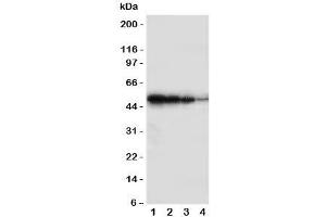 Western blot testing of BMPR1B antbody;  Lane 1: Recombinant human protein 10ng;  2: 5ng;  3: 2. (BMPR1B 抗体  (Middle Region))