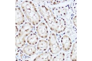 Immunohistochemistry (IHC) image for anti-Superoxide Dismutase 1, Soluble (SOD1) (AA 1-154) antibody (ABIN3020855)