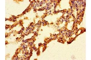 Immunohistochemistry of paraffin-embedded human lung tissue using ABIN7165390 at dilution of 1:100 (FAM131A 抗体  (AA 1-281))