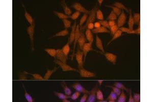 Immunofluorescence analysis of HeLa cells using PSMB6 Polyclonal Antibody at dilution of 1:100 (40x lens). (PSMB6 抗体)