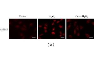 Immunofluorescence (Cultured Cells) (IF (cc)) image for anti-N-Ethylmaleimide-Sensitive Factor Attachment Protein, alpha (NAPA) (Center) antibody (ABIN2856408)