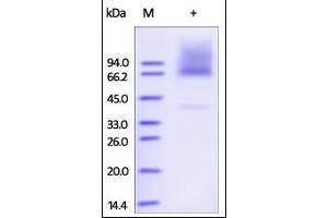 SDS-PAGE (SDS) image for Glypican 3 (GPC3) (AA 25-559) (Active) protein (His tag) (ABIN2181182)