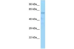 WB Suggested Anti-ZNF20 Antibody Titration: 1. (ZNF20 抗体  (C-Term))