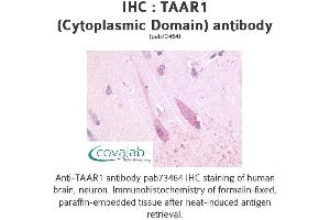 Image no. 1 for anti-Trace Amine Associated Receptor 1 (TAAR1) (3rd Cytoplasmic Domain) antibody (ABIN1739854) (TAAR1 抗体  (3rd Cytoplasmic Domain))