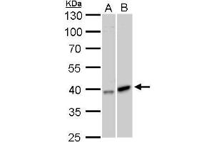 WB Image GALK1 antibody detects GALK1 protein by Western blot analysis. (GALK1 抗体)