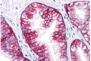 Human Prostate: Formalin-Fixed, Paraffin-Embedded (FFPE) (EpCAM 抗体)