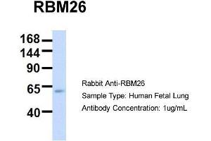 Host:  Rabbit  Target Name:  RBM26  Sample Type:  Human Fetal Lung  Antibody Dilution:  1. (RBM26 抗体  (Middle Region))