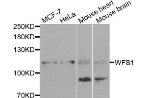 Western blot analysis of extracts of various cells, using WFS1 antibody. (WFS1 抗体)