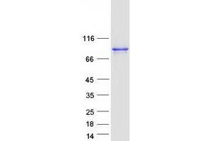 Western Blotting (WB) image for DEAD Box Protein 4 (DDX4) (Transcript Variant 1) protein (Myc-DYKDDDDK Tag) (ABIN2719283)