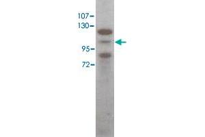 Western blot using Stat5a polyclonal antibody  shows detection of Stat5a protein in HeLa cell extract (arrowhead). (STAT5A 抗体  (C-Term))