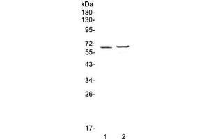 Western blot testing of 1) human placenta and 2) mouse testis lysate with RUNX1T1 antibody at 0. (RUNX1T1 抗体)