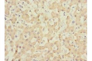 Immunohistochemistry of paraffin-embedded human liver tissue using ABIN7143271 at dilution of 1:100 (ADAMTSL4 抗体  (AA 795-1074))
