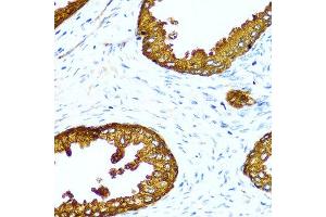 Immunohistochemistry of paraffin-embedded human prostate using ACPP antibody at dilution of 1:100 (40x lens). (ACPP 抗体)