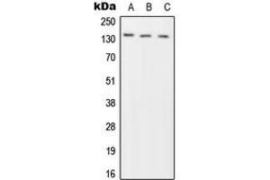 Western blot analysis of Phogrin expression in HeLa (A), SP2/0 (B), H9C2 (C) whole cell lysates. (PTPRN2 抗体  (Center))