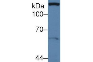 Detection of PXN in Human MCF7 cell lysate using Polyclonal Antibody to Paxillin (PXN) (Paxillin 抗体  (AA 201-461))
