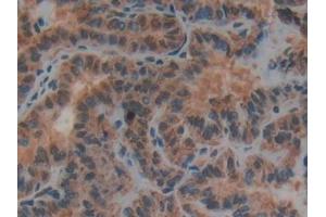 Immunohistochemistry (IHC) image for anti-Plasminogen Activator, Urokinase Receptor (PLAUR) (AA 13-114) antibody (ABIN7431179)