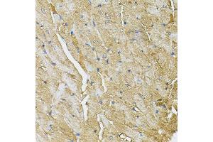 Immunohistochemistry of paraffin-embedded mouse heart using TRPC1 antibody (ABIN6003660) (40x lens). (TRPC1 抗体)