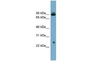 WB Suggested Anti-SLC6A5  Antibody Titration: 0. (SLC6A5 抗体  (Middle Region))