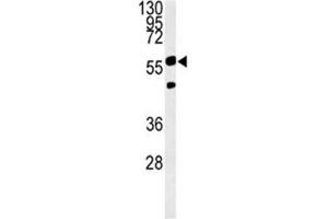 PHGDH antibody western blot analysis in Ramos lysate. (PHGDH 抗体  (AA 249-277))
